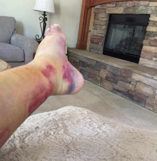 dui house arrest anklet in latrobe